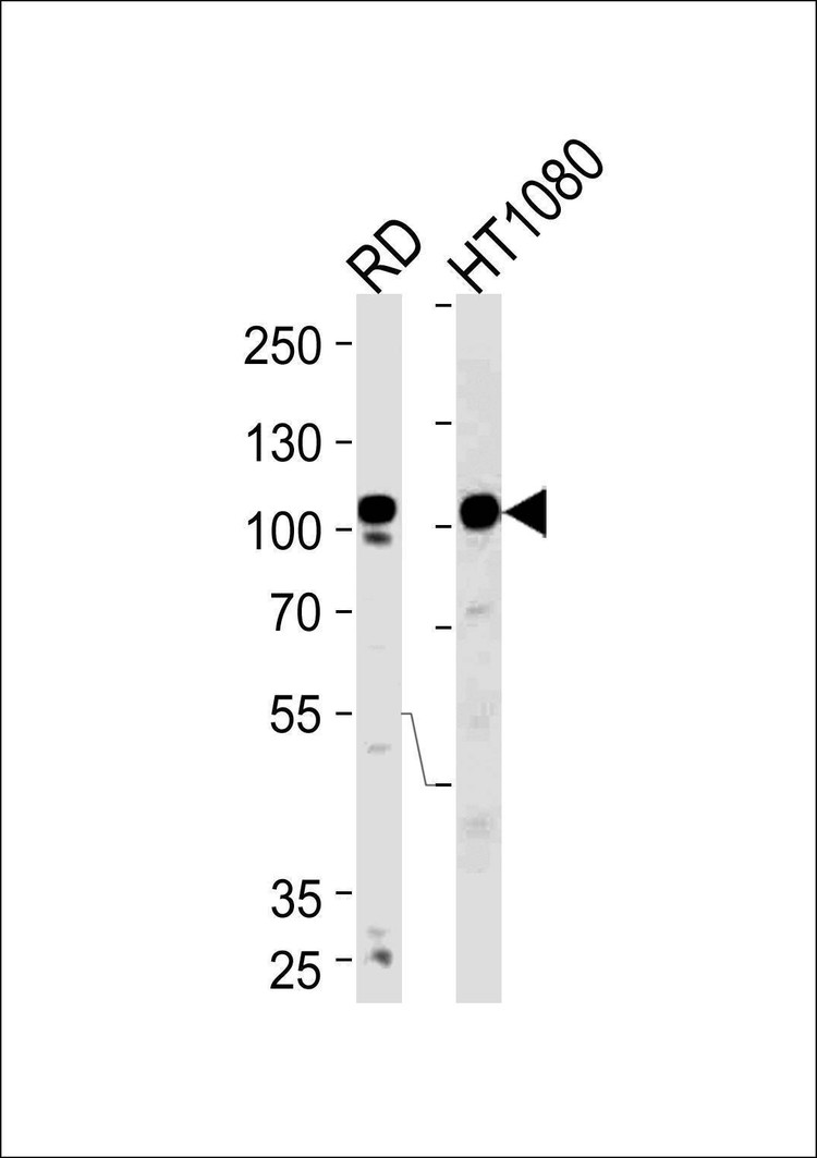 Anti-ATP2A1 (C-term) Antibody
