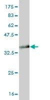 Anti-GTF3A Antibody