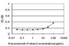 Anti-GTF3A Antibody