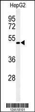 Anti-OPN1MW (N-term) Antibody