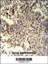 Anti-RXRA (Center) Antibody