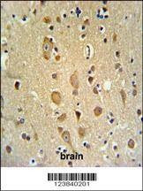 Anti-APITD1 (Center) Antibody