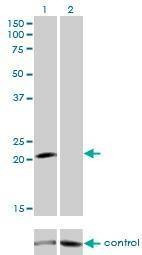 Anti-GUCA1A Antibody