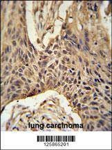 Anti-LPPR4 (C-term) Antibody