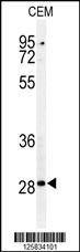 Anti-CASP3 (Asp175) Antibody