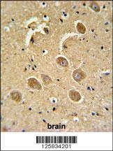 Anti-CASP3 (Asp175) Antibody