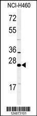 Anti-RAB27B (C-term) Antibody