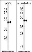 Anti-C10orf46 (C-term) Antibody