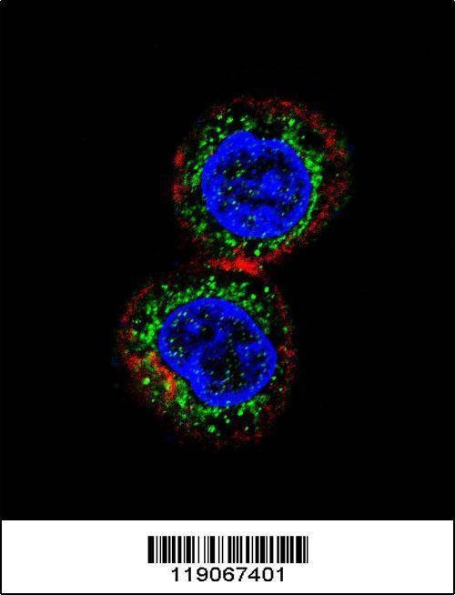 Anti-CHEK2 (N-term) Antibody