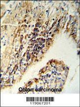 Anti-CHEK2 (N-term) Antibody