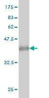 Anti-GUCY2D Antibody