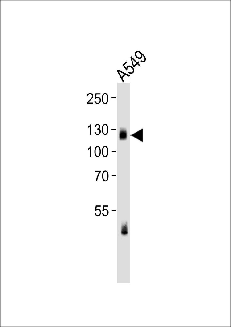Anti-EPHA2/3/4 (Ab-588/596) Antibody