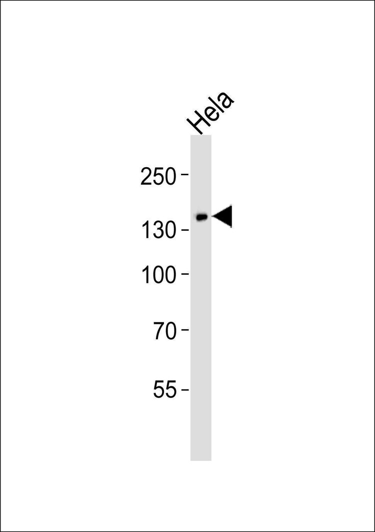 Anti-PLCG1 (Ab-771) Antibody