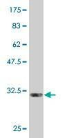 Anti-GYPC Antibody