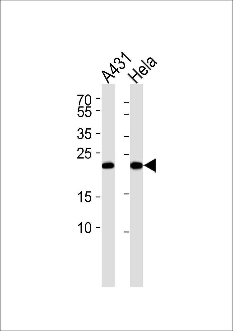 Anti-TCTP Antibody