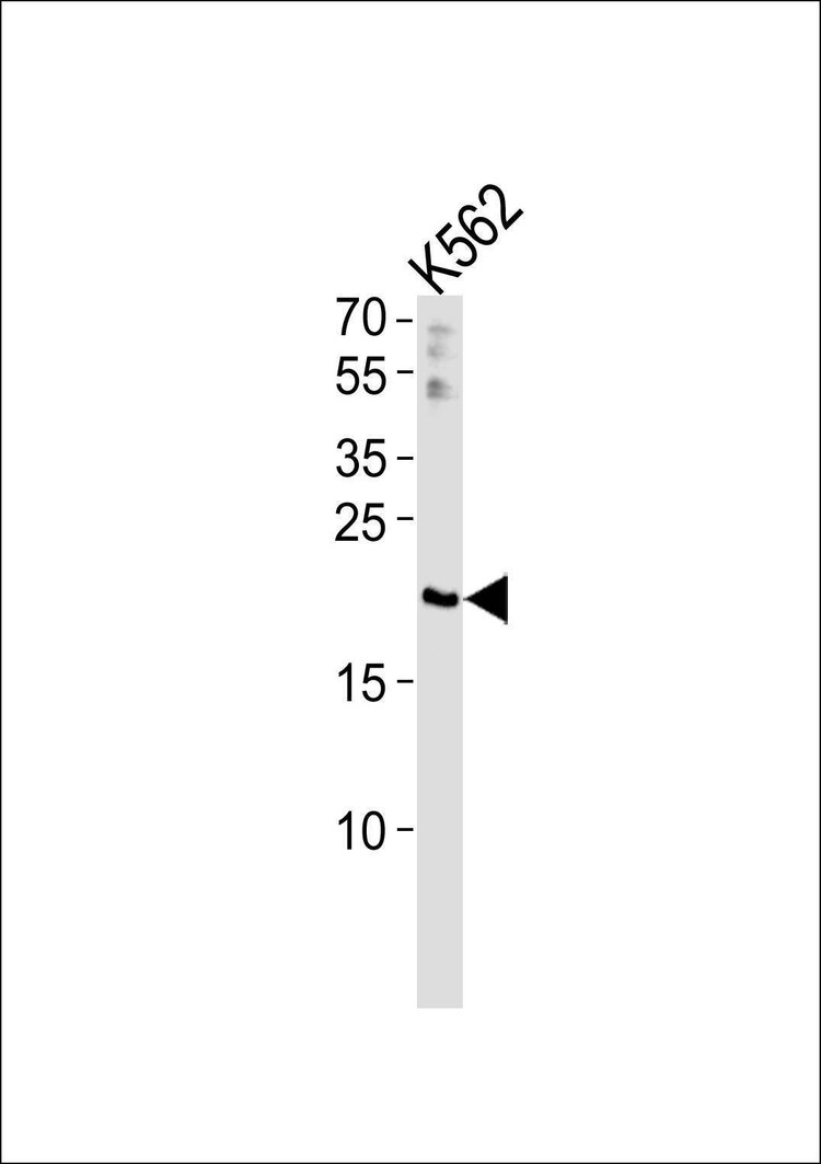 Anti-RGS10 Antibody