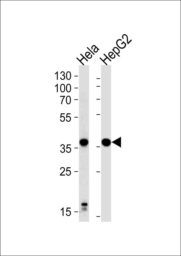 Anti-P2RY13 Antibody