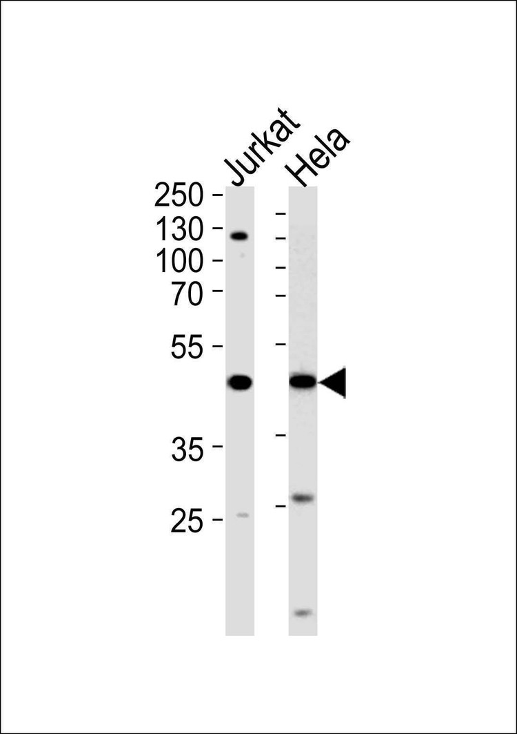 Anti-FEN1 Antibody