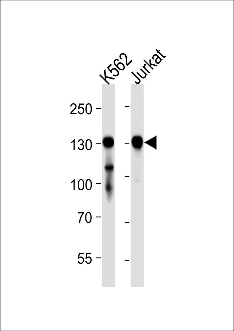 Anti-PHKB Antibody