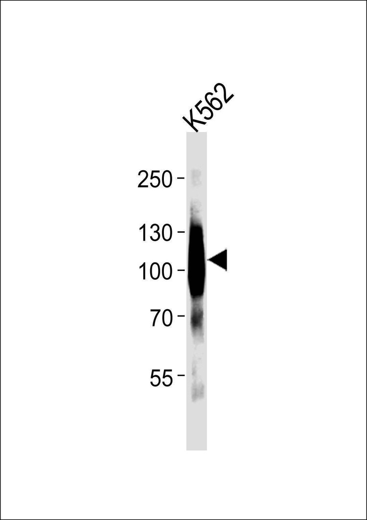 Anti-mGluR6 Antibody