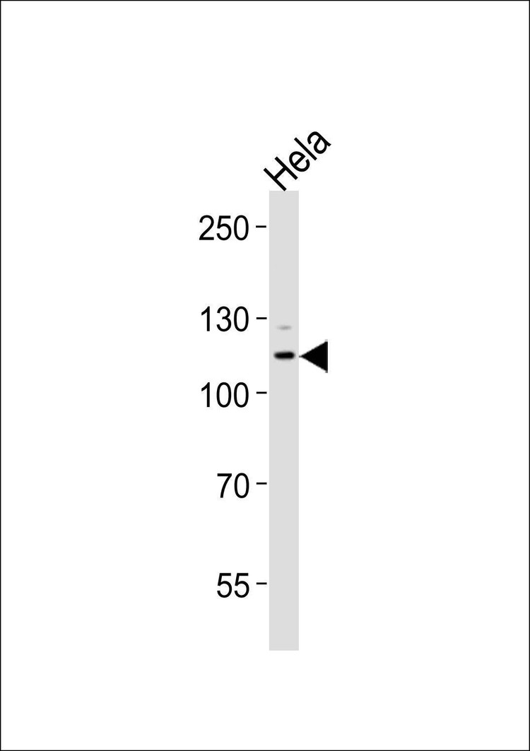 Anti-BUB1B Antibody