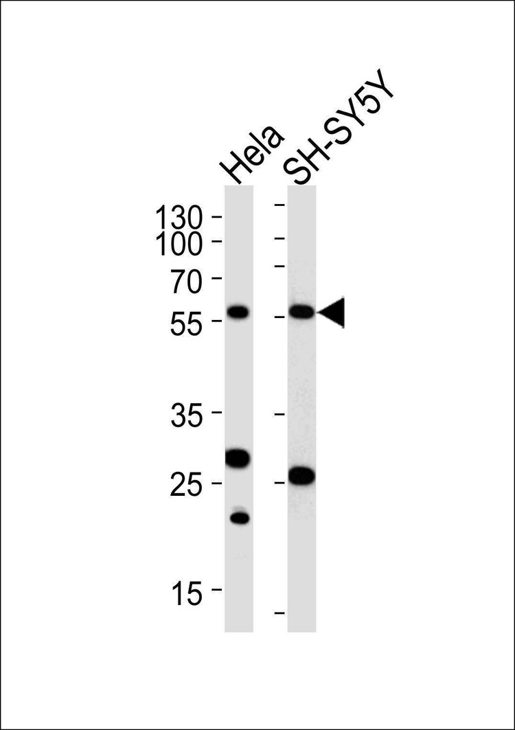 Anti-CALR Antibody