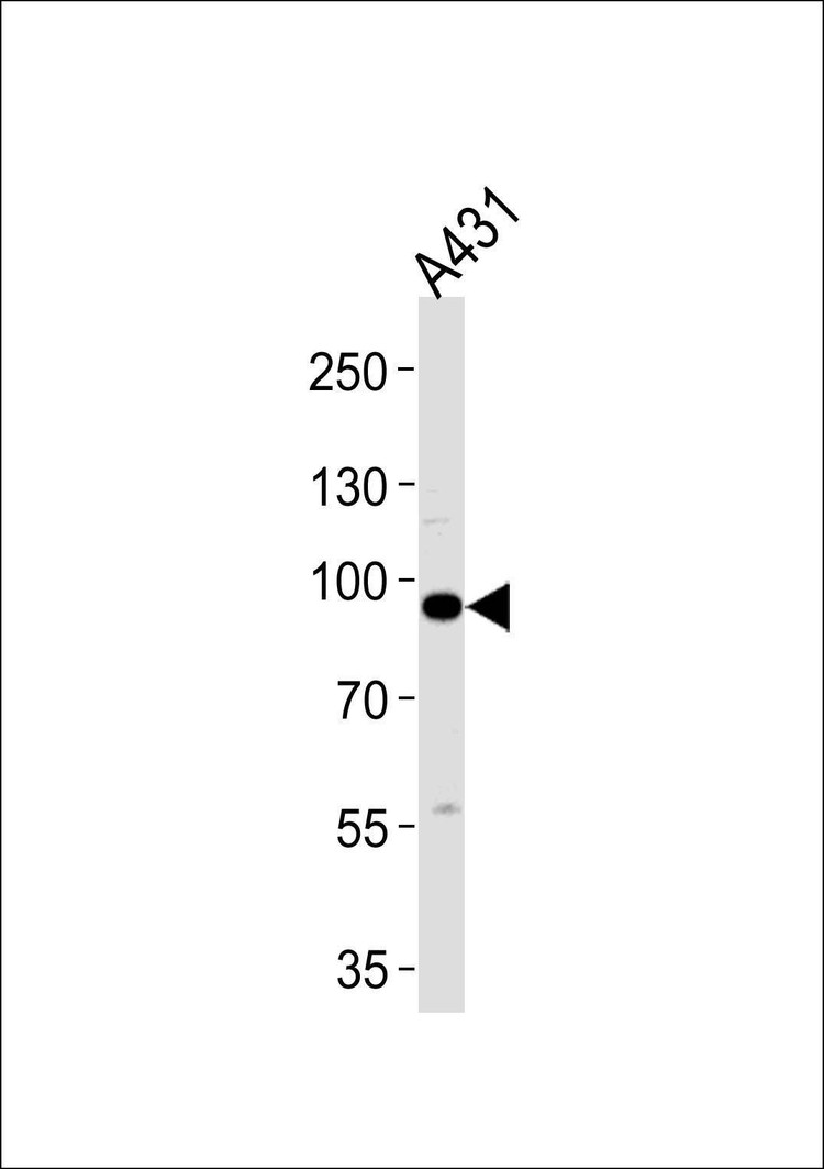 Anti-C1S Antibody