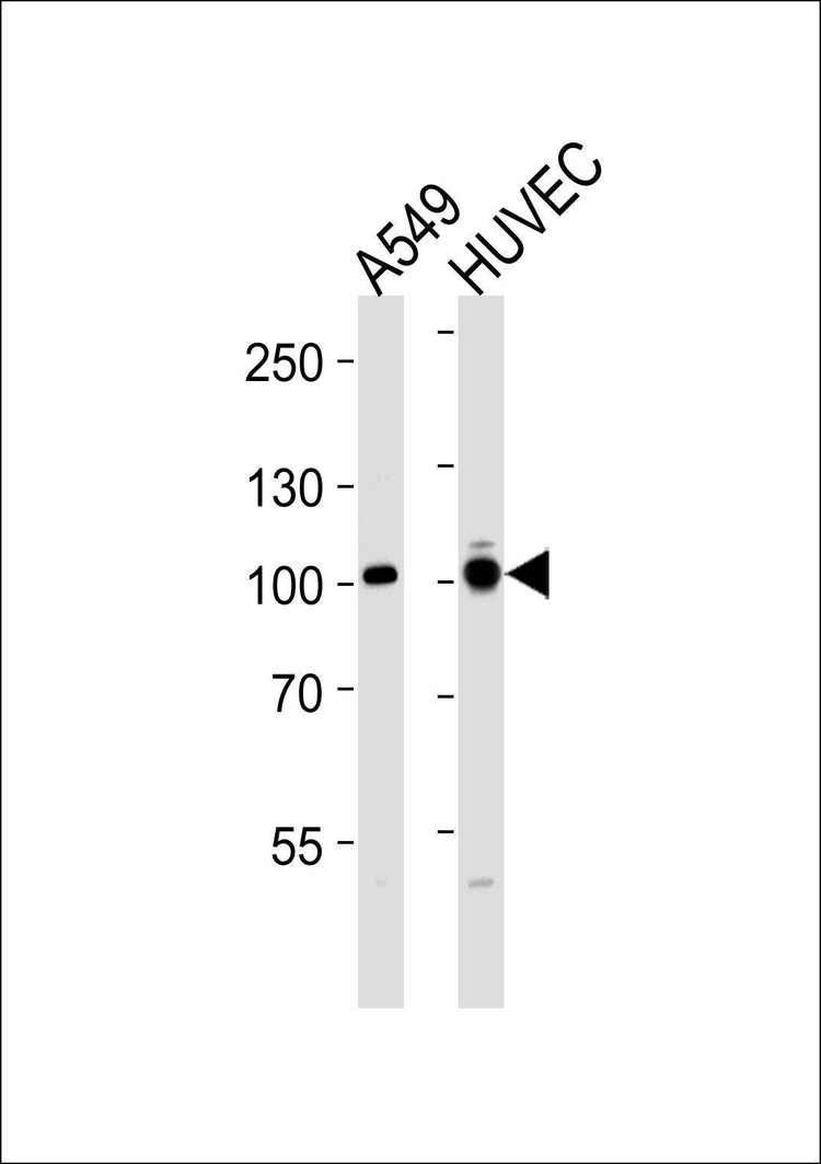 Anti-ADCY9 Antibody