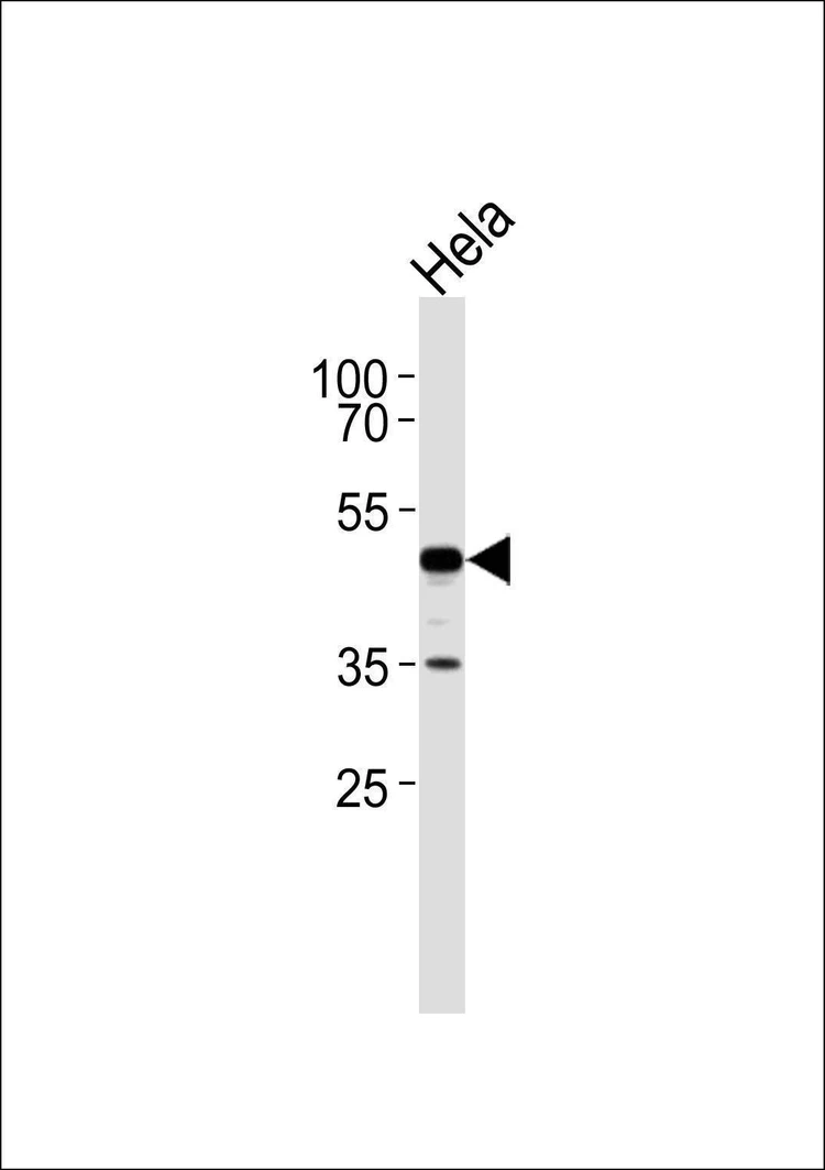 Anti-ERI1 Antibody