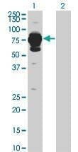 Anti-HAL Antibody