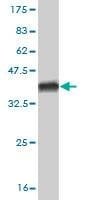 Anti-HAL Antibody