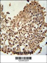 Anti-CCDC42 (Center) Antibody