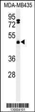 Anti-FBXL2 (C-term) Antibody