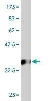 Anti-HAND2 Antibody