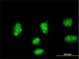 Anti-HAND2 Antibody