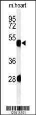 Anti-KRT82 (Center) Antibody