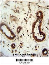 Anti-KRT82 (Center) Antibody