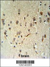 Anti-LIMD2 (N-term) Antibody