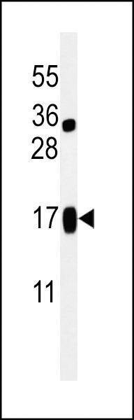Anti-LIMD2 (N-term) Antibody