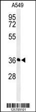 Anti-PAAF1 (N-term) Antibody