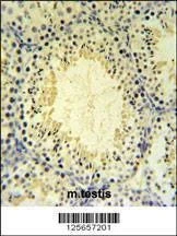 Anti-UBXN6 (C-term) Antibody