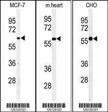 Anti-GLD2 (N-term) Antibody
