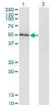 Anti-HAVCR1 Antibody
