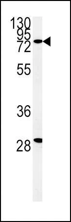 Anti-ZFYVE16 (N-term) Antibody