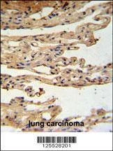 Anti-FKBPL (C-term) Antibody