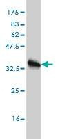 Anti-HBB Antibody