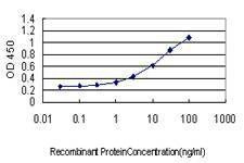 Anti-HBB Antibody