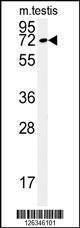 Anti-KLHL9 (Center) Antibody