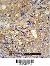 Anti-KLHL9 (Center) Antibody