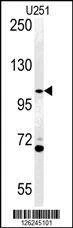 Anti-ACAP3 (N-term) Antibody
